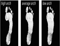 Choosing the right running shoe when dealing with achilles tendinitis