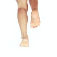Runner icing and treating achilles tendon pain